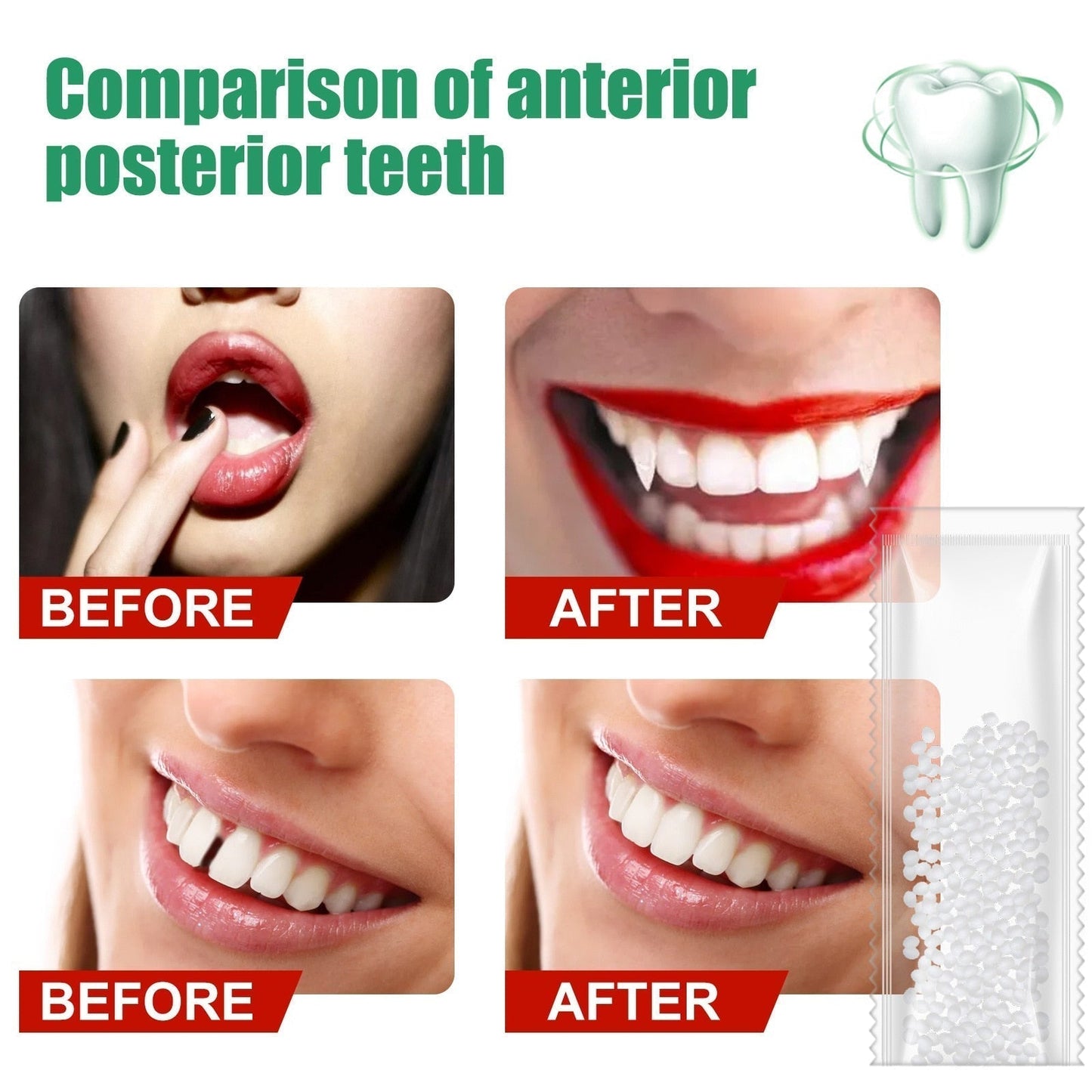 Tooth Repair Resin