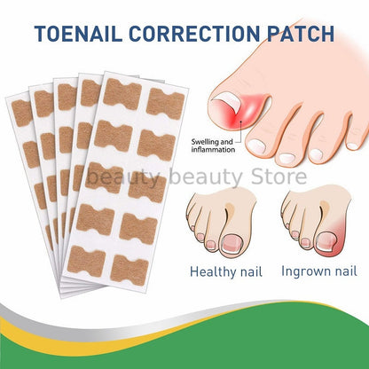 Toenail Savior Kit