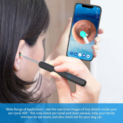 Smart Wireless Camera Otoscope