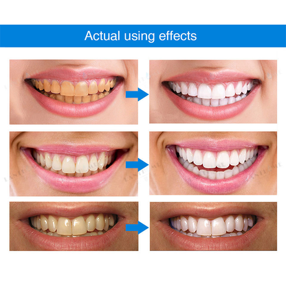 Teeth Whitening Essence