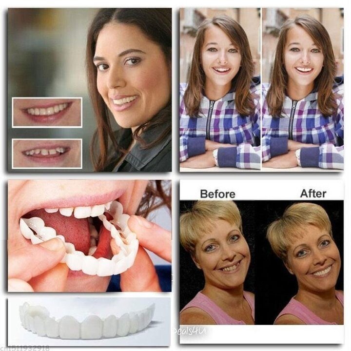 💝Last day discount-60%Off💝Latest👨‍⚕Adjustable Snap-On Dentures😁